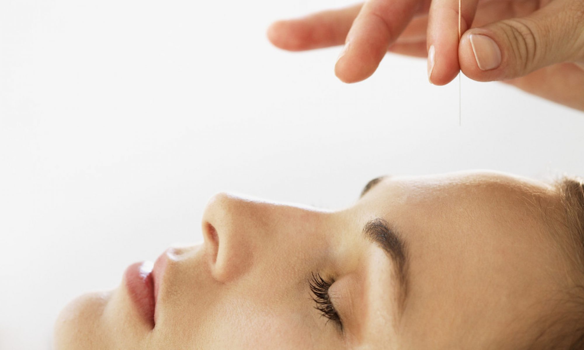 Aqupuntura facial